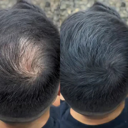 LALNSLO HairLine Powder