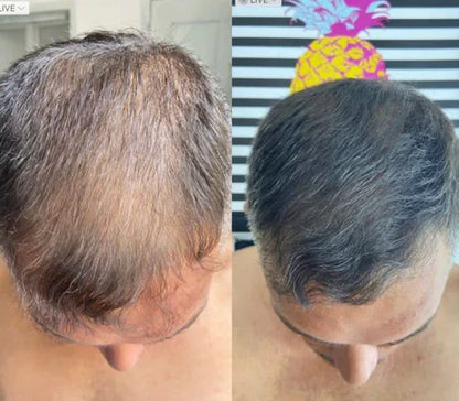 LALNSLO HairLine Powder