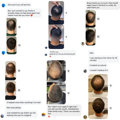 LALNSLO HairLine Powder